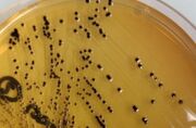 SalmonellaSSagar.jpg