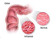 ibd in dogs inflammatory bowel disease canine diabetes wiki fandom powered by wikia ibd in dogs inflammatory bowel disease canine diabetes wiki fandom powered by wikia