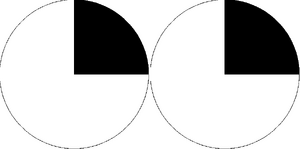 Right superior quadrantanopia