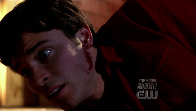File:'s ear bleeds.jpg