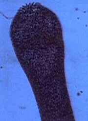 Tapeworm scolex