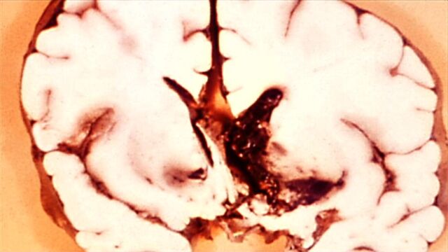 File:Sf3-biothreat.jpg