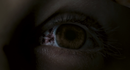 AndyBloodshotEye