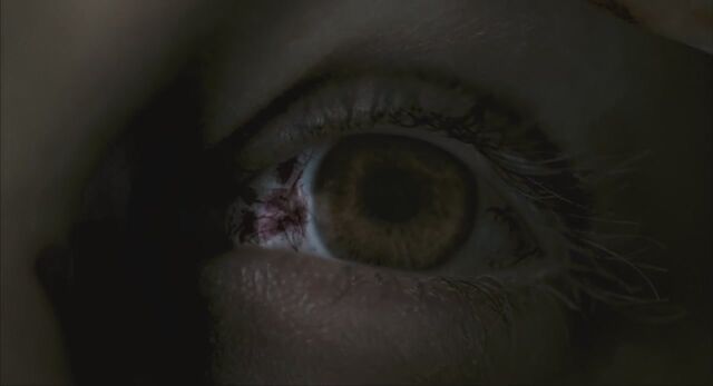 File:AndyBloodshotEye.jpg