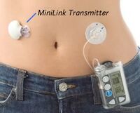 Minimed CGMS