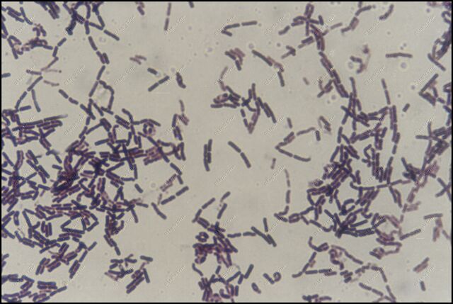 Arquivo:Diplobacilos.jpg