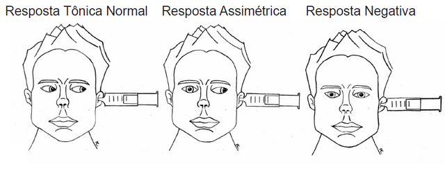 Arquivo:Neuro11.png
