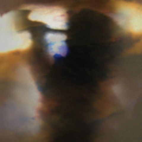 File:FallBeKind AlbumCover.png