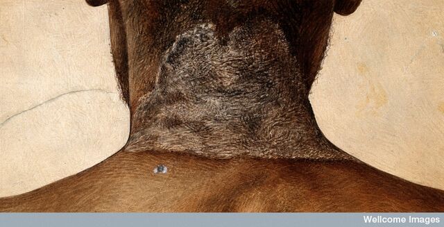 Ficheiro:Pellagra-butterfly.jpg