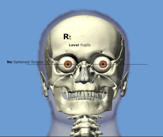 File:Right Sphenoid Torsion Animation.gif