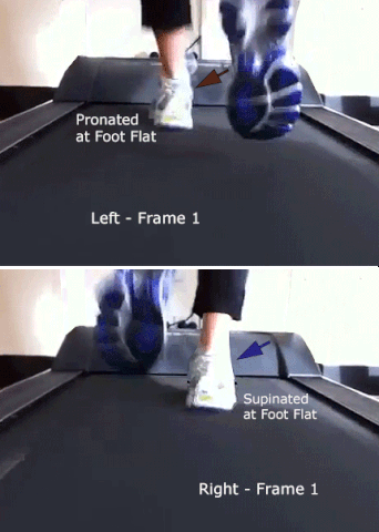 File:Treadmill Video Mixed Pattern.gif
