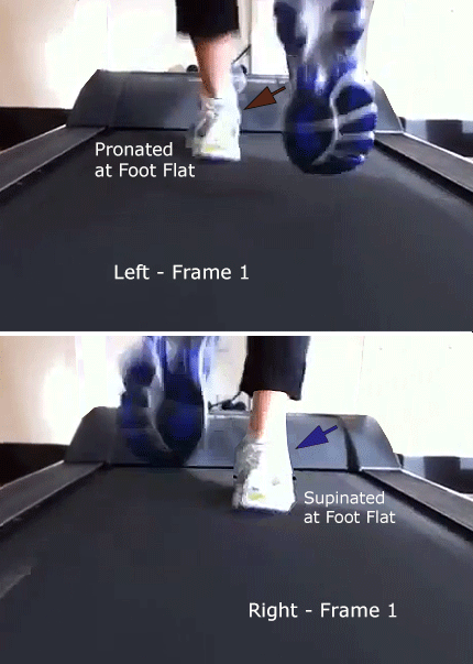 Treadmill Video Mixed Pattern