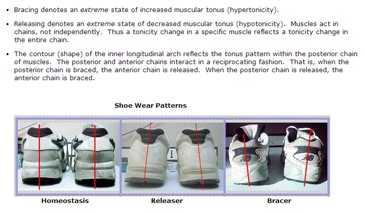 Bracing Patterns Info with Pictures Shoes