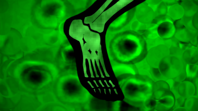File:TFB1 (155).png