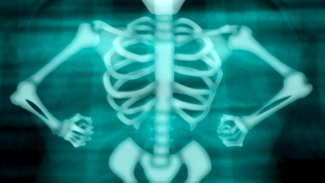 File:ATG (117).png