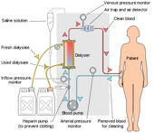 400px-Hemodialysis-en svg