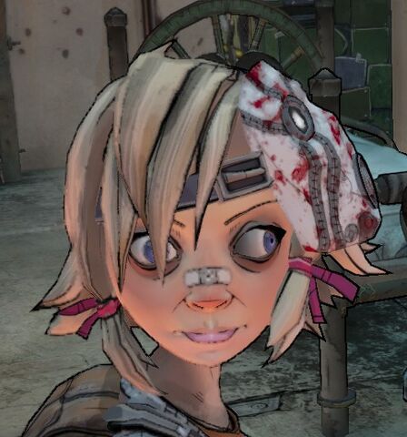 File:Tina's Lazy Eye (Close).jpg