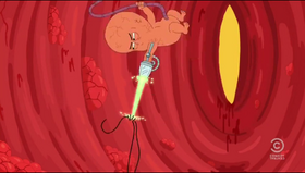 Abortiageddon