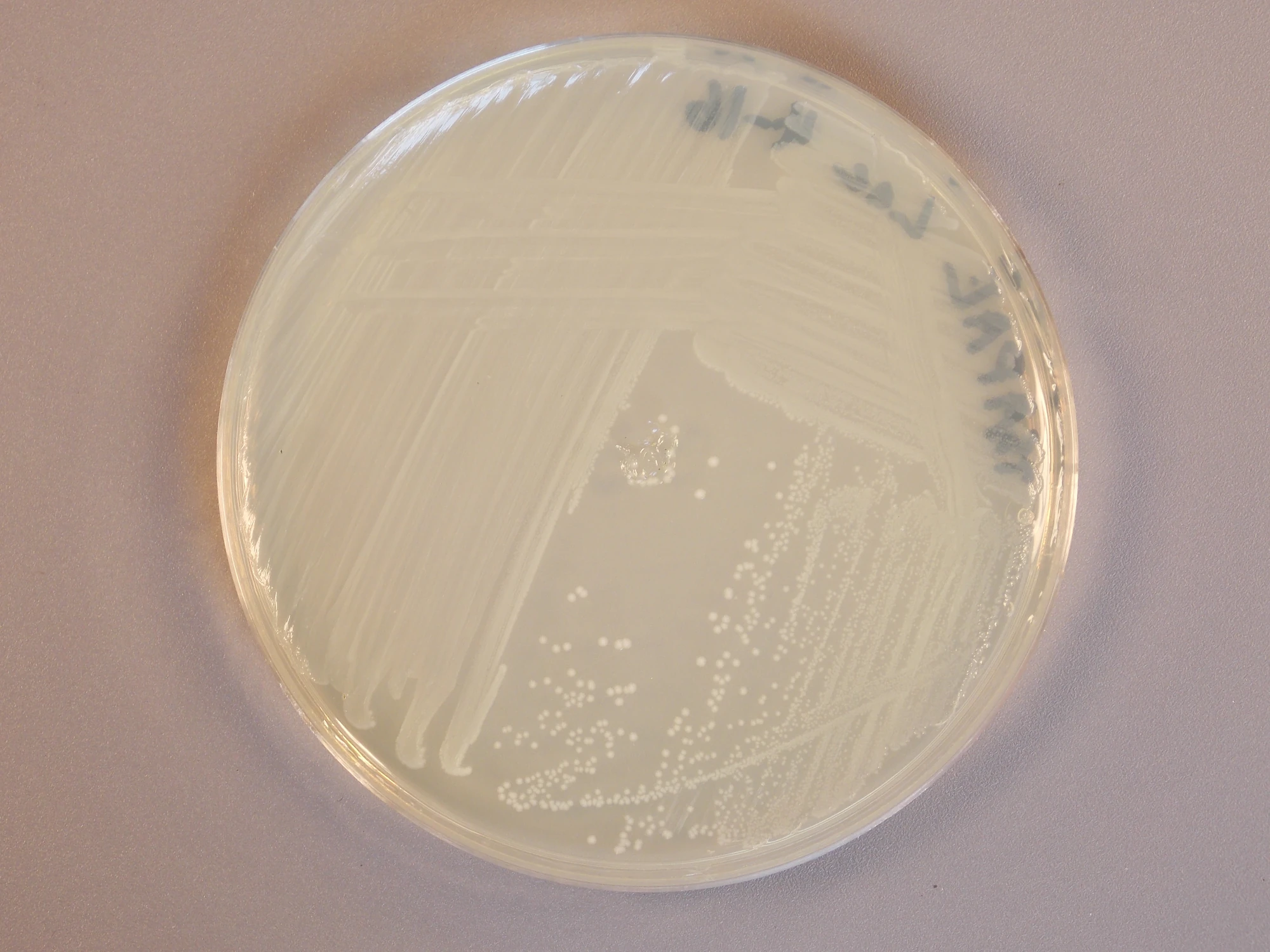 Image Lactobacillus acidophilus.JPG Classroom Bacterial