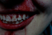 Bloody smile