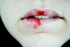 Lip biting