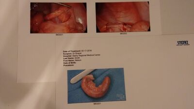 IMG 20160224 183802392