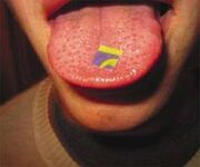 LSD