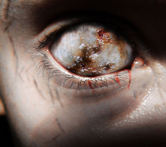 File:Blink.jpg
