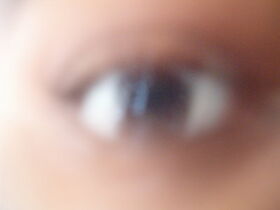 Blurred-vision