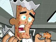 Ecto-acne.jpg