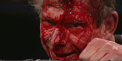 Vince-mcmahon-blood