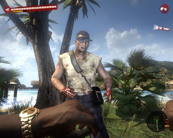 File:Infected (Male).jpg