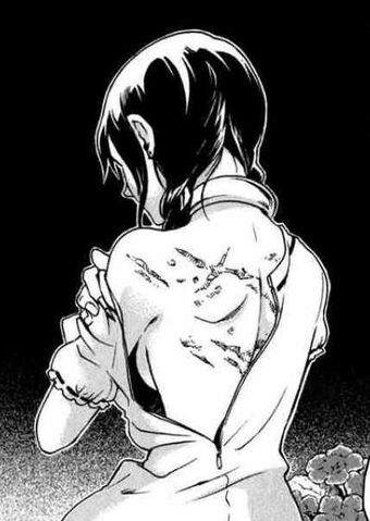 File:Minatsuki scars.jpg