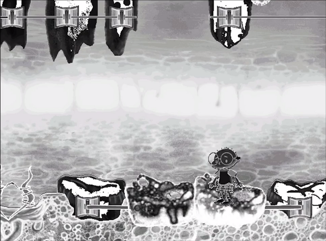 File:X-Ray Tooth.png