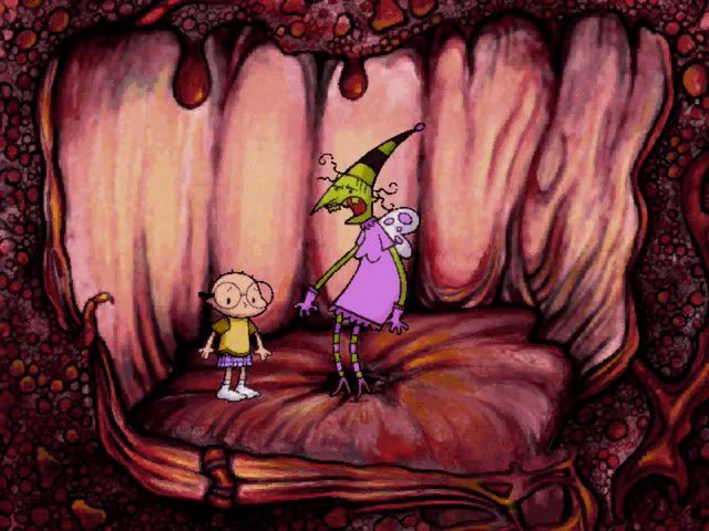 File:Gingivitis.png