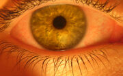 Bloodshot EyeBall.jpg