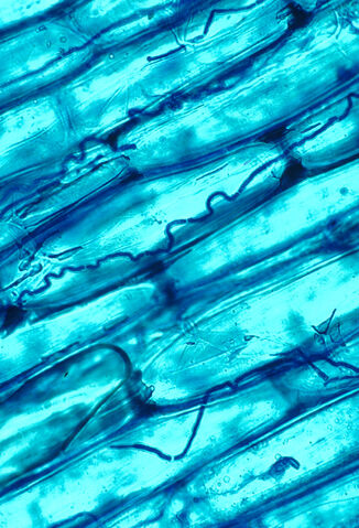 Datei:Neotyphodium coenophialum.jpg
