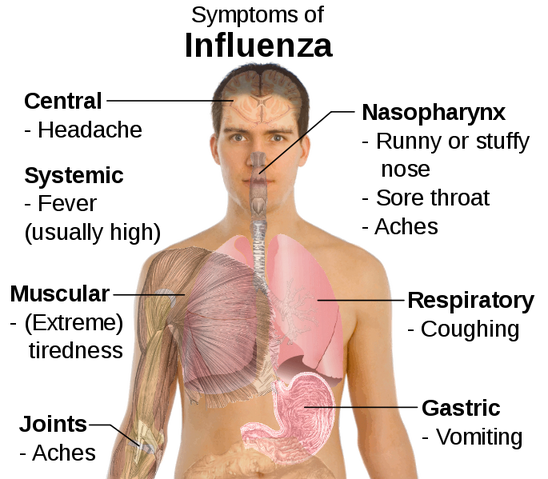 File:Flu symptoms.png