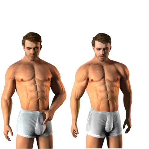 Archivo:Himplantsenhancementsurgery texture2out.png