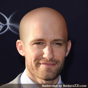 Matthew-Morrison-balderized