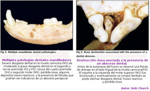 Dientes13.jpg