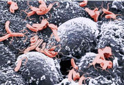 Helicobacter.jpg