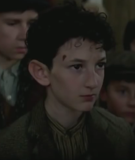 Boy_with_birthmark.png