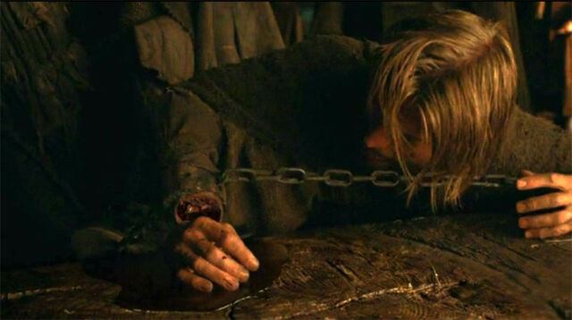 Archivo:Amputación Jaime HBO.jpg