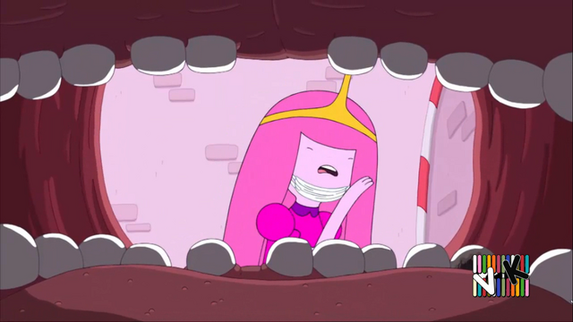 Archivo:T-Dent 01.png