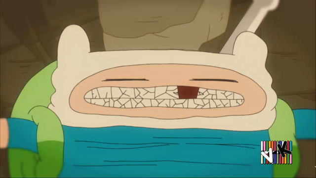 Archivo:T-Dent 33.png