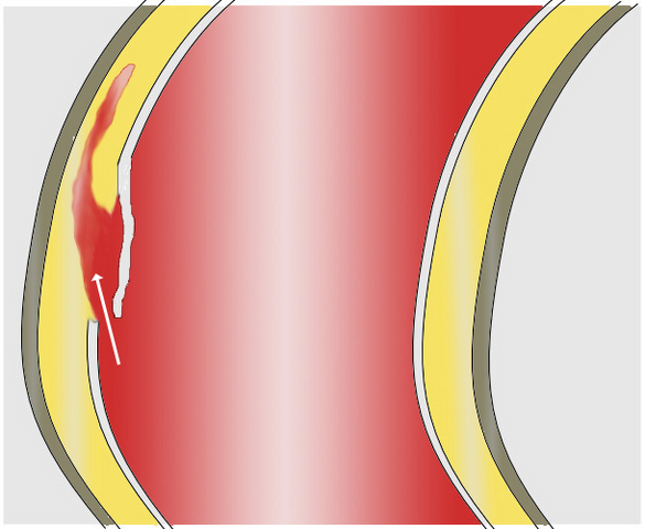 File:AoDissect Schema 01a.png