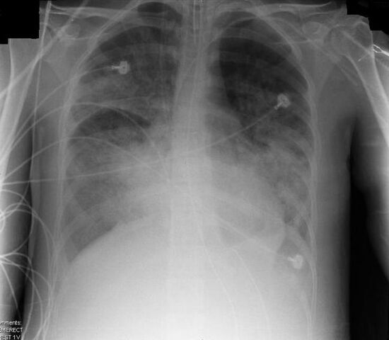 File:AARDS X-ray cropped.jpg