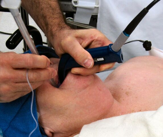 File:Glidescope 02.jpg