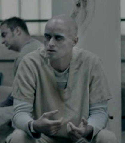 File:Bald unknown pds sufferer.png